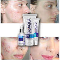 KIT ANTI ACNE BIOAQUA